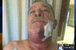 72-year-old attacked, via screengrab