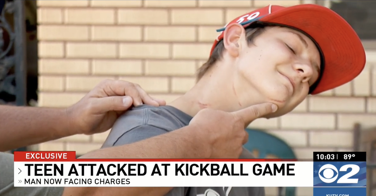 The 13-year-old boy who was allegedly attacked by Christopher Wiggins shows his injuries during an interview with KUTV.