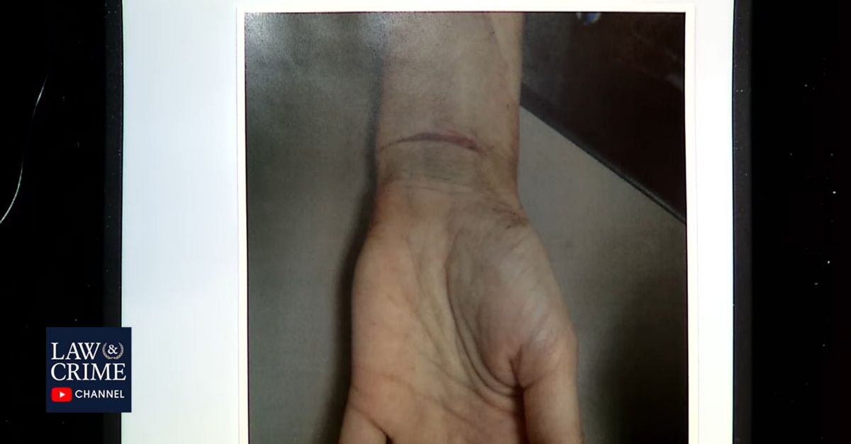 Alisa Mathewson's slit but healing left wrist.